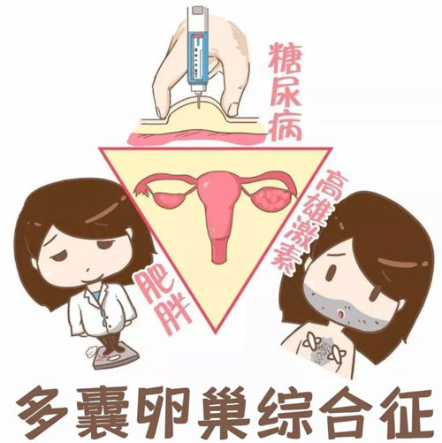 多囊性卵巢综合征如何检查出来？尽早发现，尽早调理！